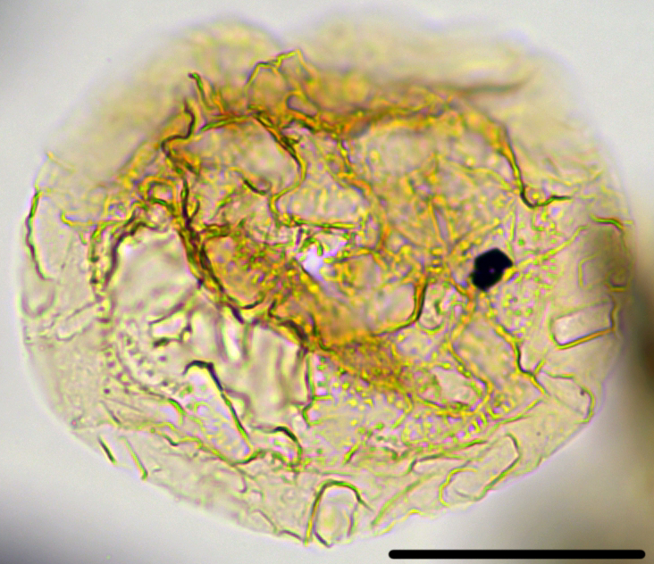 Heteraulacacysta pramparoae HprampX27390921351040Bc holotype 63x.jpg